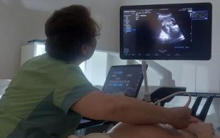 Новый аппарат УЗИ экспертного класса появился в первоуральской акушерской службе