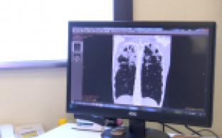 Коварная бактерия, которая может надолго затаиться в организме человека и подорвать его здоровье