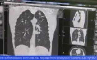 Уровень заражённости туберкулёзом в Первоуральске выше, чем по области