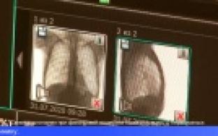 Медики напоминают об опасности туберкулёза