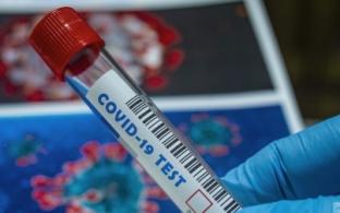 Роспотребнадзор изменил правила сдачи ПЦР-тестов на COVID для прибывающих из-за рубежа жителей России