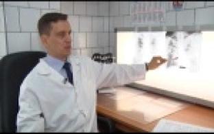 Медики призывают первоуральцев пройти флюорографию