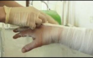 Из-за гололеда первоуральцы стали чаще обращаться в травмпункт