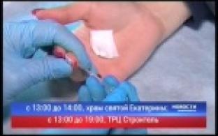 Тест на ВИЧ в мобильной лаборатории
