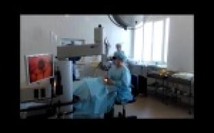 Ультразвуковая микрохирургия глаза в Первоуральске