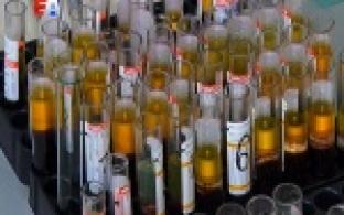 Исследования на ВИЧ и другие заболевания теперь будут проводить быстрее